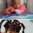 延安6岁女童肚子里长拳头大淋巴瘤 呼吁您的爱心 - 中国在线