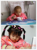延安6岁女童肚子里长拳头大淋巴瘤 呼吁您的爱心 - 中国在线