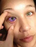 噩梦！加拿大女模做眼球纹身致永久性损伤 - 西安网