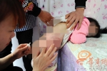 西安女童幼儿园掉进热水桶 教育局：责令停园整顿 - 古汉台