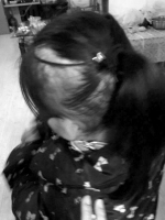 女孩遭生母虐打 才6岁头发掉了一半 - 西安网