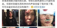 西安女子被丈夫用茶海打致颅脑损伤 警方介入调查 - 华商网