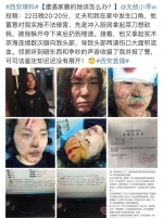 西安女子被丈夫用茶海打致颅脑损伤 警方介入调查 - 华商网