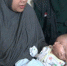 印尼产妇诞双脸畸胎 曾做三次产检 - 西安网