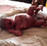 印度一男婴长有四条腿两套生殖器 当地人敬畏围观 - 西安网