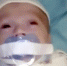 俄医院12周大婴儿遭胶带强行固定奶嘴叫人心疼 - 西安网