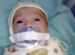 俄医院12周大婴儿遭胶带强行固定奶嘴叫人心疼 - 西安网