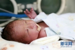 中国首个移植子宫内孕育宝宝在西京医院出生 - 西安网