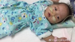 河南“巴掌宝宝”将出院 经5个多月治疗体重增至12斤 - 西安网