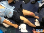 香港有暴徒在多处投掷汽油弹 一名警察被严重烧伤 - 西安网