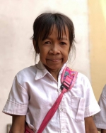 柬埔寨10岁女孩满脸皱纹似六旬老人 常遭同伴取笑 - 西安网