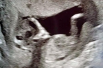 英孕妇做B超发现腹中胎儿形似外星人，担心被前任诅咒被吓坏了 - 西安网