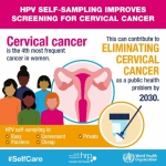 女性生殖道感染与宫颈癌防治赋能项目系列活动开展，互联网+HPV自取样宫颈癌筛查模式受关注 - 西安网